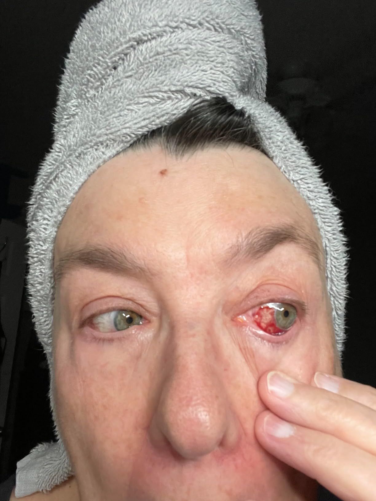 Thé NutraVision pour la santé et le confort des yeux